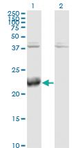 Anti-ATF3 Mouse Monoclonal Antibody [clone: 8G5]