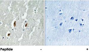 Anti-SRF Rabbit Polyclonal Antibody