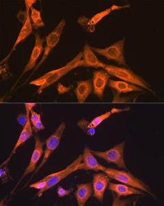 Immunofluorescence analysis of NIH-3T3 cells using Anti-S100 alpha 6/PRA Antibody [ARC2005] (A306836) at a dilution of 1:100 (40X lens). DAPI was used to stain the cell nuclei (blue)