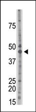 Anti-CKII alpha (CSNK2A1) Rabbit Polyclonal Antibody