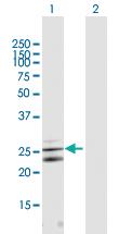 Anti-CLCF1 Mouse Polyclonal Antibody