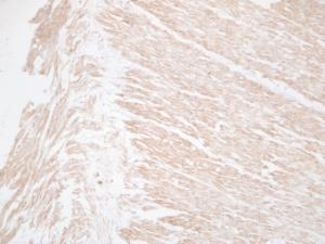 Immunohistochemical analysis of paraffin-embedded human Colon using Anti-Desmin Antibody