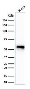 Western blot analysis of human HeLa cell lysate using Anti-Cytokeratin 7 Antibody [SPM270]