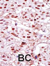 Anti-CKII alpha (CSNK2A1) Rabbit Polyclonal Antibody