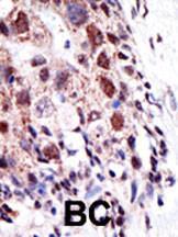 Anti-UBE2S Rabbit Polyclonal Antibody (PE (Phycoerythrin))