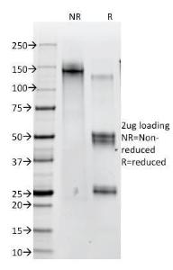 SDS-PAGE analysis of Anti-beta Catenin Antibody [12F7] under non-reduced and reduced conditions; showing intact IgG and intact heavy and light chains, respectively. SDS-PAGE analysis confirms the integrity and purity of the antibody.