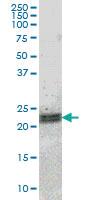 Anti-ATF3 Mouse Monoclonal Antibody [clone: 7G10]