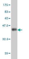 Anti-ACAP2 Mouse Monoclonal Antibody [clone: 4G3]