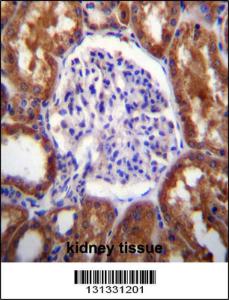 Anti-SLC12A6 Rabbit Polyclonal Antibody (FITC (Fluorescein Isothiocyanate))