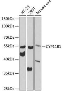 Western blot analysis of extracts of various cell lines, using Anti-CYP11B1 Antibody (A12156) at 1:1,000 dilution