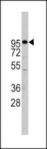 Anti-ADAM17 Rabbit Polyclonal Antibody (FITC (Fluorescein))