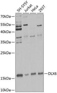 Western blot analysis of extracts of various cell lines, using Anti-Dlx6 Antibody (A12157) at 1:1,000 dilution