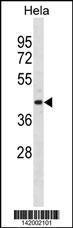 Anti-ADPRH Rabbit Polyclonal Antibody (HRP (Horseradish Peroxidase))