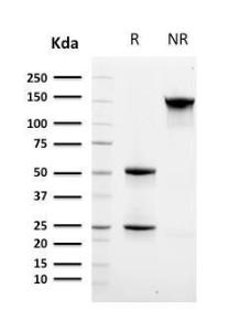 SDS-PAGE analysis of Anti-CD8A Antibody [C8/468 + C8/144B] under non-reduced and reduced conditions; showing intact IgG and intact heavy and light chains, respectively. SDS-PAGE analysis confirms the integrity and purity of the antibody