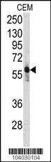 Anti-PFKFB3 Rabbit Polyclonal Antibody