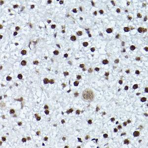 Immunohistochemistry analysis of paraffin-embedded mouse liver using Anti-ATR (phospho Thr1989) Antibody (A308032) at a dilution of 1:200 (40X lens). Perform high pressure antigen retrieval with 10 mM citrate buffer pH 6.0 before commencing with IHC staining protocol