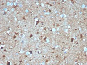 Immunohistochemical analysis of formalin-fixed, paraffin-embedded human brain using Anti-S100 beta Antibody [S100B/4139]