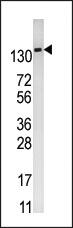 Anti-PFKFB2 Rabbit Polyclonal Antibody