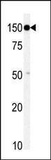 Anti-TAOK1 Rabbit Polyclonal Antibody (AP (Alkaline Phosphatase))