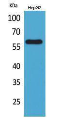 Western blot analysis of HepG2 cells using Anti-ASIC3 Antibody