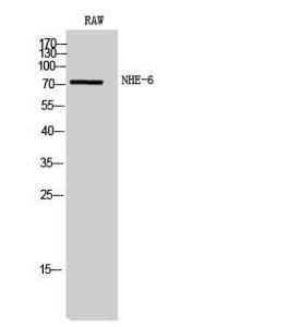 Western blot analysis of RAW cells using Anti-SLC9A6 Antibody