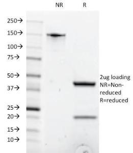 Anti-CD8A antibody