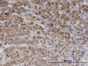 Anti-PIK3C2A Mouse Monoclonal Antibody [clone: 3E7]