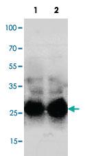 Anti-SFTPA1 Rabbit Polyclonal Antibody