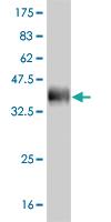 Anti-OLIG2 Mouse Monoclonal Antibody [clone: 3C9]