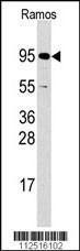 Anti-RPS6KA3 Rabbit Polyclonal Antibody (AP (Alkaline Phosphatase))