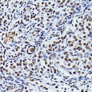 Immunohistochemistry analysis of paraffin-embedded rat ovary using Anti-ATR (phospho Thr1989) Antibody (A308032) at a dilution of 1:200 (40X lens). Perform high pressure antigen retrieval with 10 mM citrate buffer pH 6.0 before commencing with IHC staining protocol