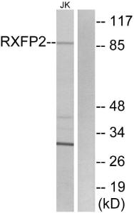 Western blot analysis of lysates from Jurkat cells using Anti-RXFP2 Antibody The right hand lane represents a negative control, where the antibody is blocked by the immunising peptide