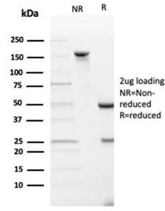 SDS-PAGE analysis of Anti-SPARC Antibody [OSTN/3933] under non-reduced and reduced conditions; showing intact IgG and intact heavy and light chains, respectively. SDS-PAGE analysis confirms the integrity and purity of the antibody