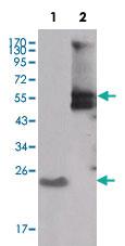 Anti-SRC Mouse Monoclonal Antibody [clone: 4F1E8]