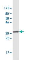 Anti-ZIC1 Mouse Monoclonal Antibody [clone: 1D12]