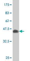 Anti-CREM Mouse Monoclonal Antibody [clone: 3B5]