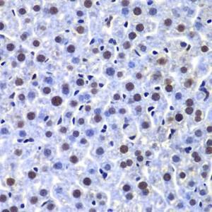 Immunohistochemistry analysis of paraffin-embedded mouse liver using Anti-DNA PKcs Antibody (A12159) at a dilution of 1:100 (40x lens) Perform microwave antigen retrieval with 10 mM PBS buffer pH 72 before commencing with IHC staining protocol