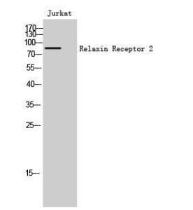 Western blot analysis of Jurkat cells using Anti-RXFP2 Antibody