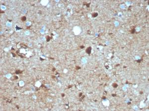 Immunohistochemical analysis of formalin-fixed, paraffin-embedded human brain using Anti-S100 beta Antibody [S100B/4139]