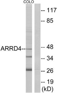 Antibody anti-ARRD4 100 µg