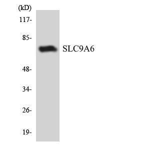 Western blot analysis of the lysates from COLO205 cells using Anti-SLC9A6 Antibody