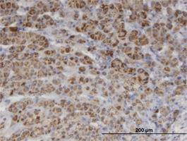 Anti-PIK3C2A Mouse Monoclonal Antibody [clone: 3E7]