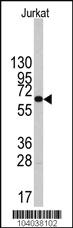 Anti-PFKFB1 Rabbit Polyclonal Antibody