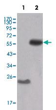 Anti-SRC Mouse Monoclonal Antibody [clone: 5D10C4]