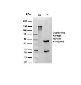 SDS-PAGE analysis of Anti-S100 beta Antibody [S100B/4139] under non-reduced and reduced conditions; showing intact IgG and intact heavy and light chains, respectively. SDS-PAGE analysis confirms the integrity and purity of the Antibody