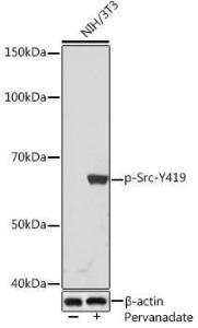 Western blot analysis of extracts of NIH/3T3 cells, using Anti-Src (phospho Tyr419) Antibody [ARC1572] (A308034) at 1:1,000 dilution