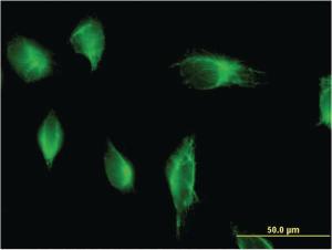 Anti-PIK3C2A Mouse Monoclonal Antibody [clone: 3E7]