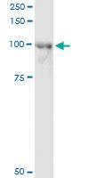 Anti-ACAP2 Mouse Monoclonal Antibody