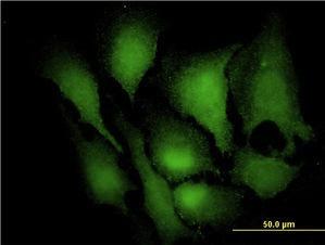 Anti-MAP Kinase 3 Mouse Monoclonal Antibody [clone: 3C9]