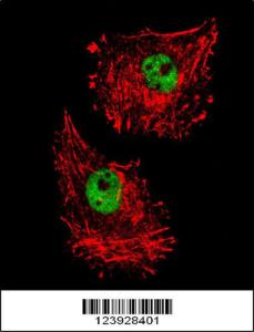 Anti-FUS Rabbit Polyclonal Antibody (FITC (Fluorescein Isothiocyanate))